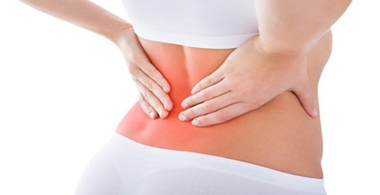 sciatica